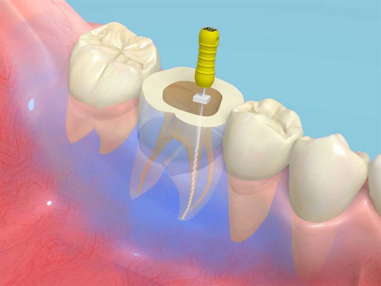 おざき歯科医院の矯正治療の特徴