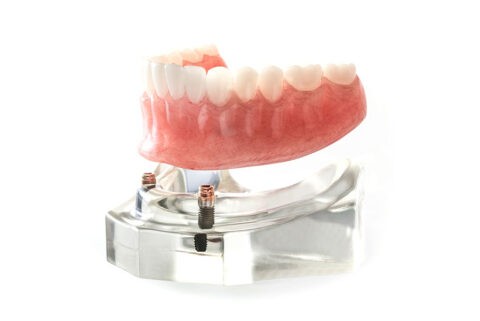 初めての歯内療法症例検討会終了 2008年02月05日23:45